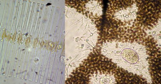 Two images of phytoplankton are shown; the rectangular cell walls of diatoms on the left and round cells of microcystis on the right.