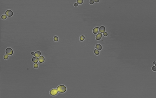 Yeast, expressing a yellow fluorescent protein, dividing.