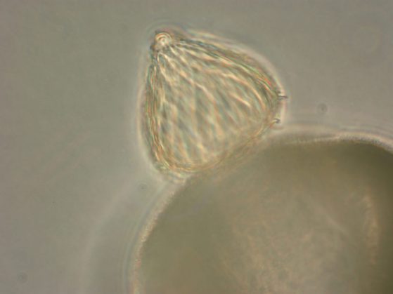 Blyttiomyces helicus on spruce pollen grain